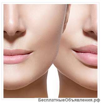 Увеличение губ