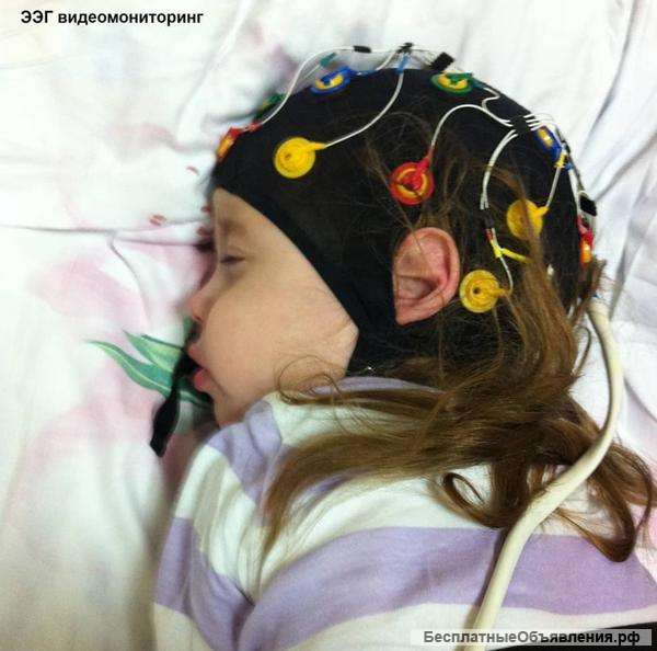 ЭЭГ с видеомониторингом сна