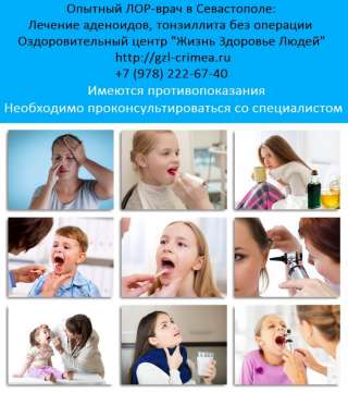 ЛОР-врач в Севастополе. Лечение аденоидов. Лечение тонзиллита