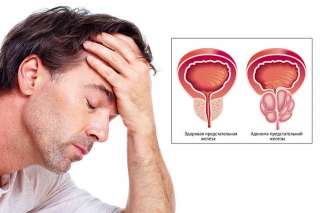 Мужской массаж для здоровья органов малого таза