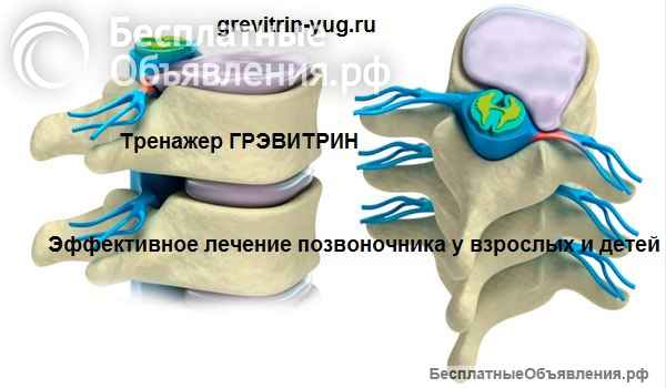 Тренажер для лечения позвоночника Грэвитрин купить в Ярославле