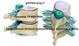 Тренажер для лечения позвоночника Грэвитрин купить в Ярославле