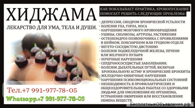 Делаю Хиджама (Кровопускание)