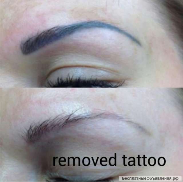 Татуаж. Перманентный макияж. Удаление татужа и татуировок.