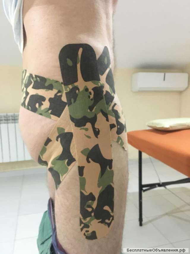 Тейпирование