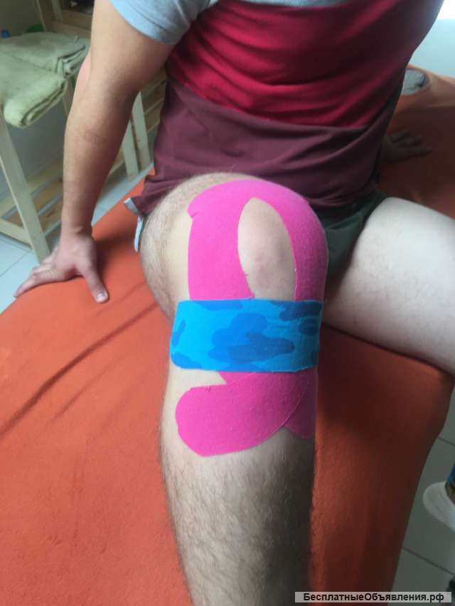 Кинезиотейпирование