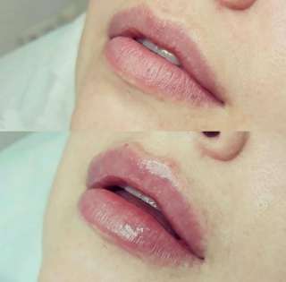 Лікар-косметолог пропонує послуги у сфері естетичної медицини в Києві