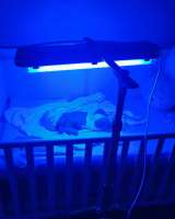 Аренда двойной лампы для лечения желтухи у малышей. Лечение на дому. Лампы новые