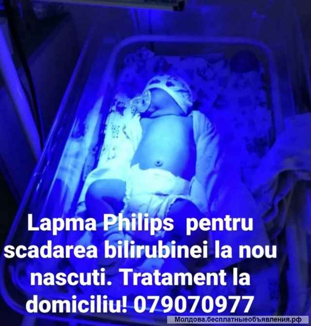 Аренда двойной лампы для лечения желтухи у малышей. Лечение на дому. Лампы новые