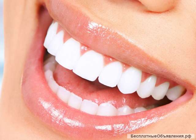 Керамическая коронка