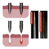 Иглы текстурированные 1R к машинкам для татуажа