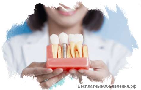 Имплантация