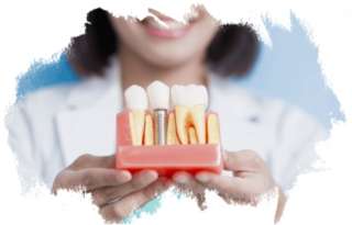 Имплантация