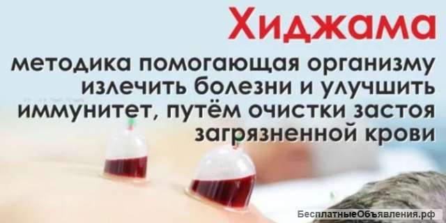 Хиджама