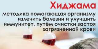 Хиджама