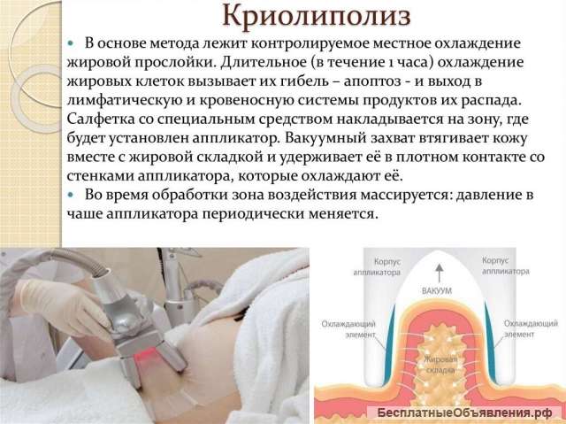 Криолиполиз на Авиамоторной