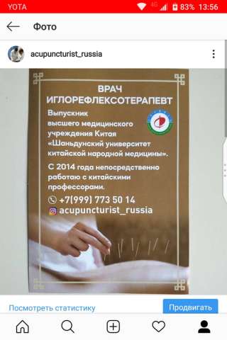 Иглоукалывание, массаж
