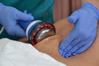 Криолиполис, кавитация, RF лифтинг лица и тела, LPG массаж