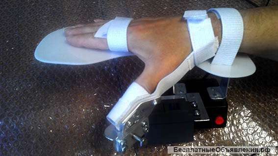 Реабилитация большого пальца после инсульта