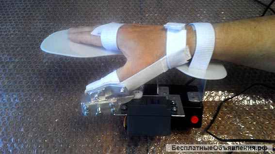 Реабилитация большого пальца после инсульта