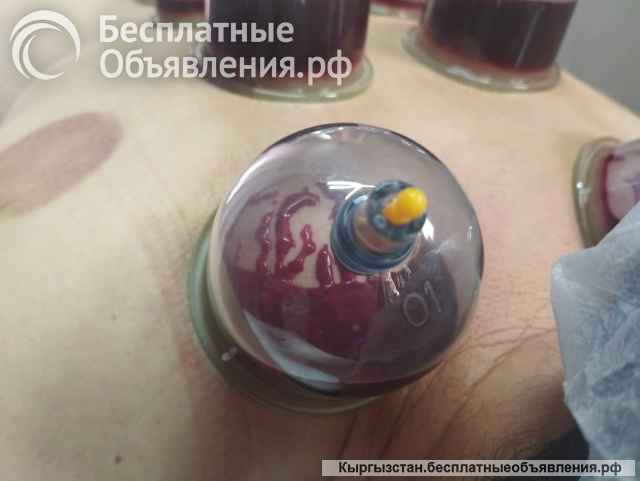 Все виды массажа. Хиджама. Мастера с опытом 12 лет.