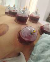 Все виды массажа. Хиджама. Мастера с опытом 12 лет.