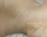 Депиляция ВОСК ШУГАРИНГ Воскресенск