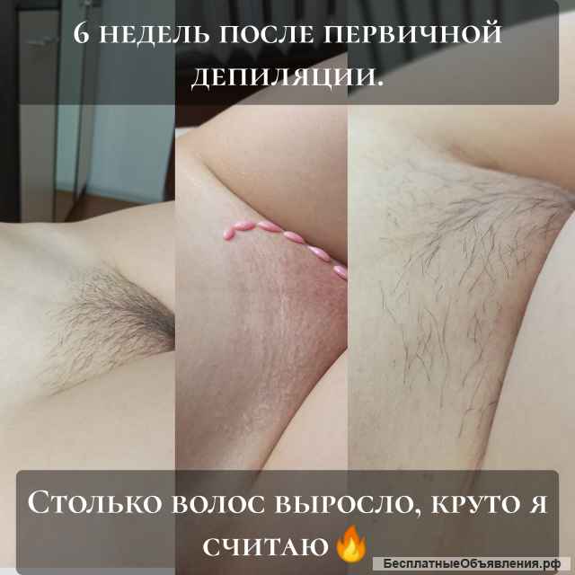 Депиляция ВОСК ШУГАРИНГ Воскресенск