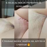 Депиляция ВОСК ШУГАРИНГ Воскресенск