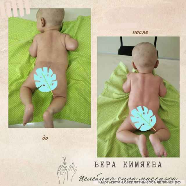 Детский и взрослый массажист с 18 летним опытом, Aрапова Вера Валерьевнa