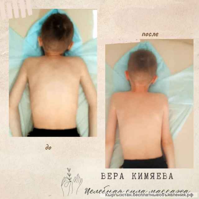 Детский и взрослый массажист с 18 летним опытом, Aрапова Вера Валерьевнa