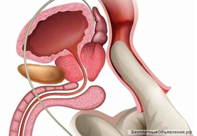 Врач, Массаж общий, массаж простаты, МЖ и др