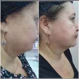 Кабинет массажа косметолога эстетиста