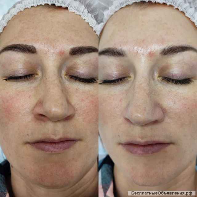 Врач Косметолог в "Mozart House"