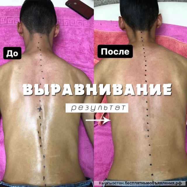 Костоправ твоего тела "Азис"