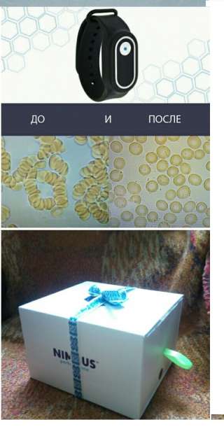 Бытовой Электромагнитный браслет Nimbus с технологией cm2-нет тромбов