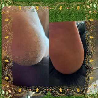 Аппаратный маникюр и Smart-педикюр