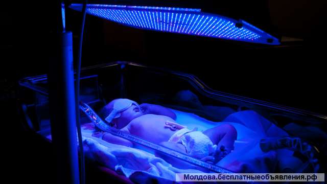 Лампа фототерапия от желтушки. Аренда У вас на дому лечение желтухи новорожденных. Кишинев. Молдова