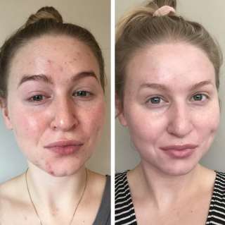 Ищу модель на процедуры в СПА