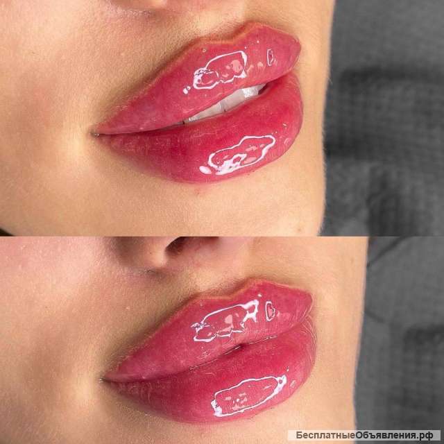 Полный спектр косметологических услуг