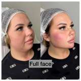 Полный спектр косметологических услуг