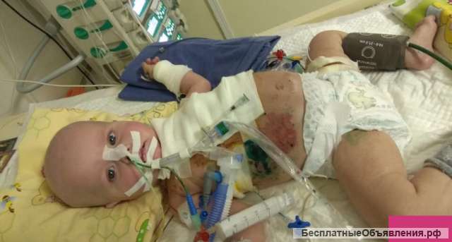 Прошу помощи Диагноз: ДЦП, спастическая диплегия с выраженным нарушением двигательных функций. ЗПМР