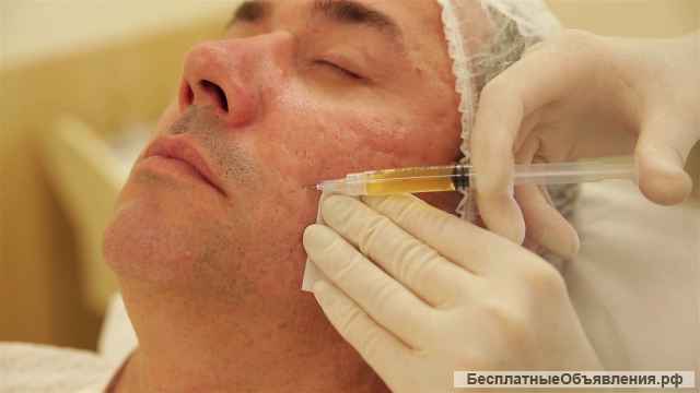 Плазмотерапия