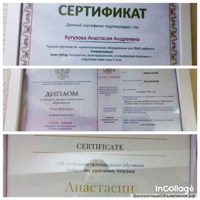 Смас-лифтинг (омоложение лица и тела)