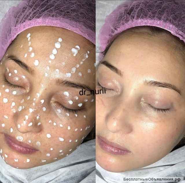 Косметолог +79257992418 ватсап