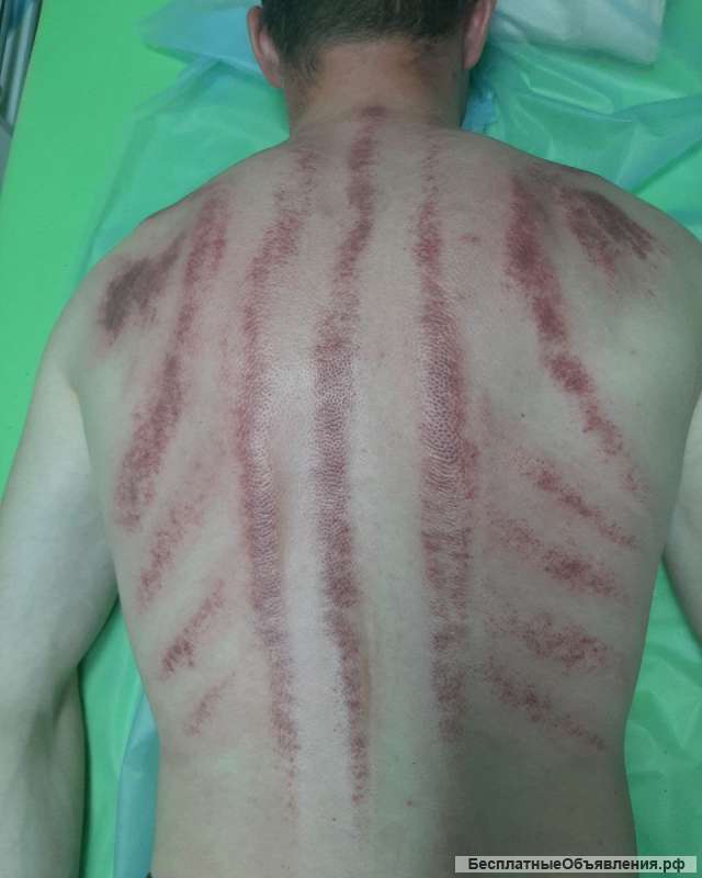 Обучу классическим методикам массажа