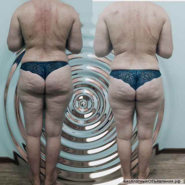 Обучу классическим методикам массажа