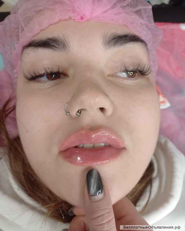 Увеличение губ