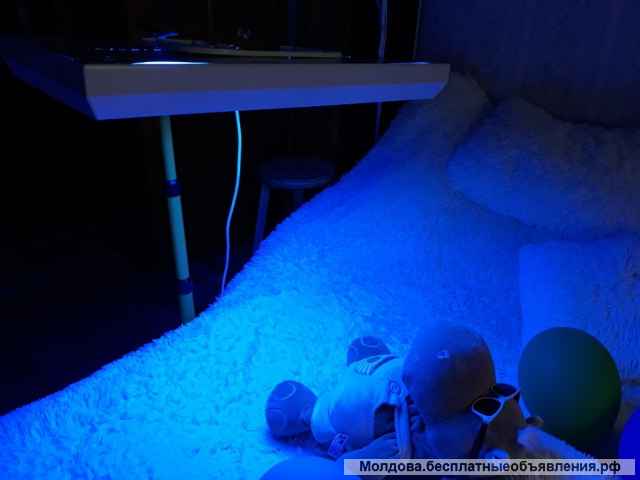 Аренда лампы для лечения желтухи у малышей на дому. Фототерапия КИШИНЕВ. + 37379070977.