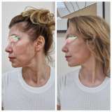 Ручной массаж "Золотые ручки мастера"